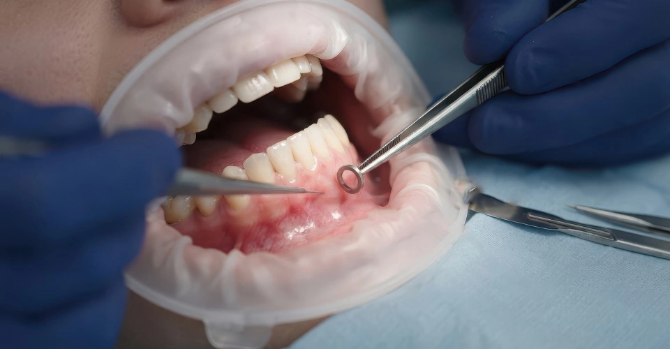 Oral biopsy procedure and diagnostic evaluation